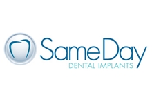 Same Day Dental Implants
