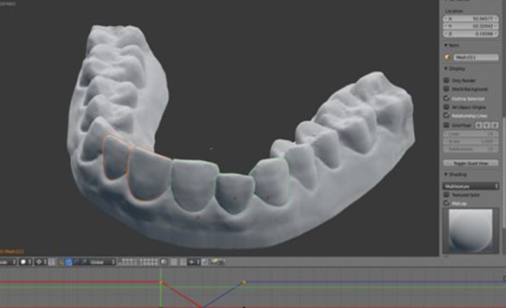 3D printing plastic braces for $60