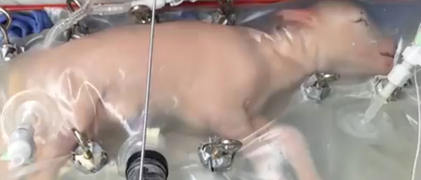 Children's Hospital of Philadelphia 'artificial womb' life-changer for premature babies